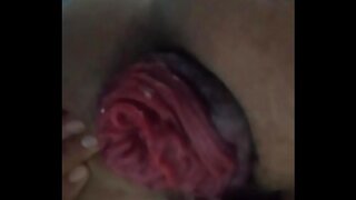 Intense Gay Sex – Extreme Anal Prolapse Pushes Boundaries